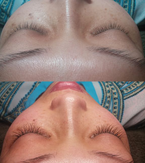 Luxe Eyelash Extensions client before and after vertical.